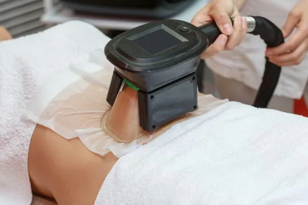 Image of person having fat freezing treatment to help weight gain Wales