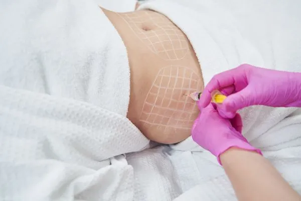 image of fat dissolving injections on love handles to help combat weight gain Wales