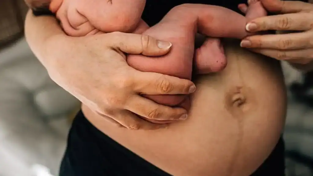 Why Is My Stomach Still Big After Pregnancy Wales?